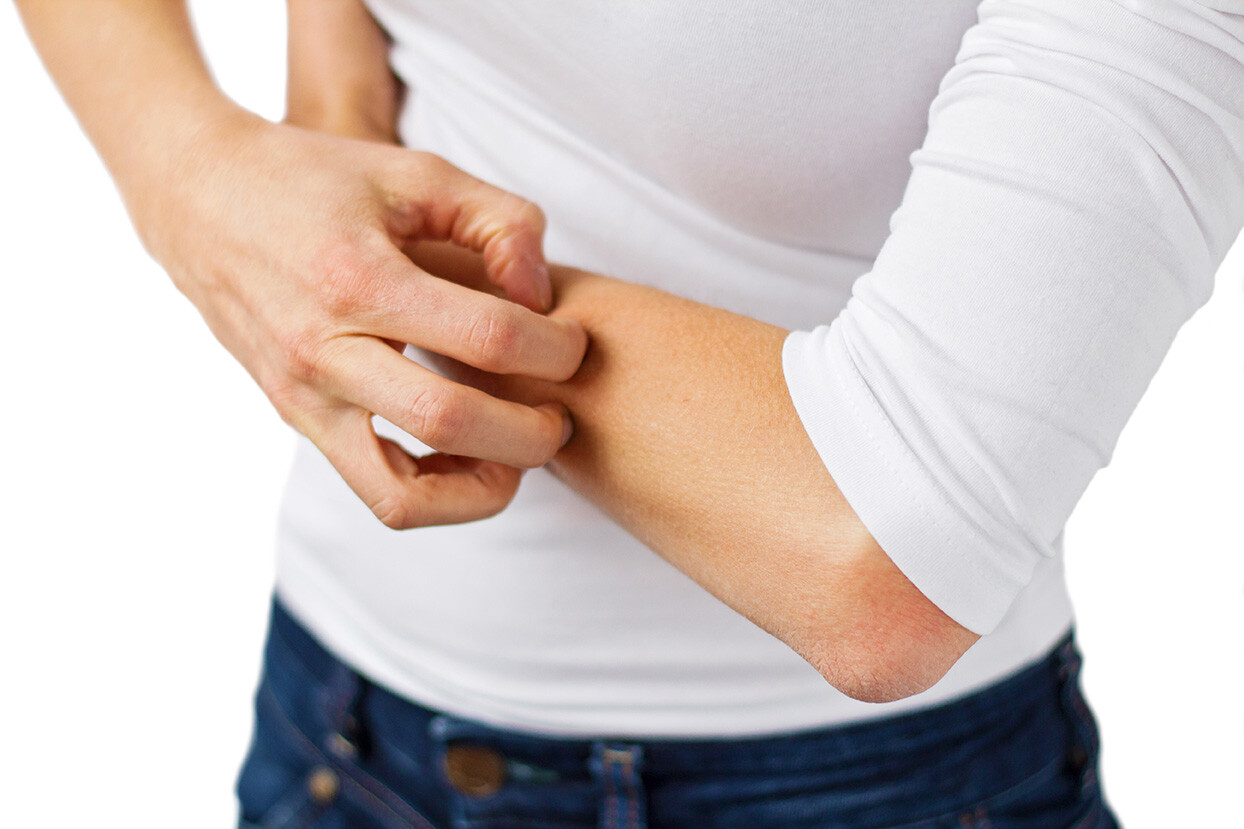 Allergic Skin Reaction: Is it Eczema?
